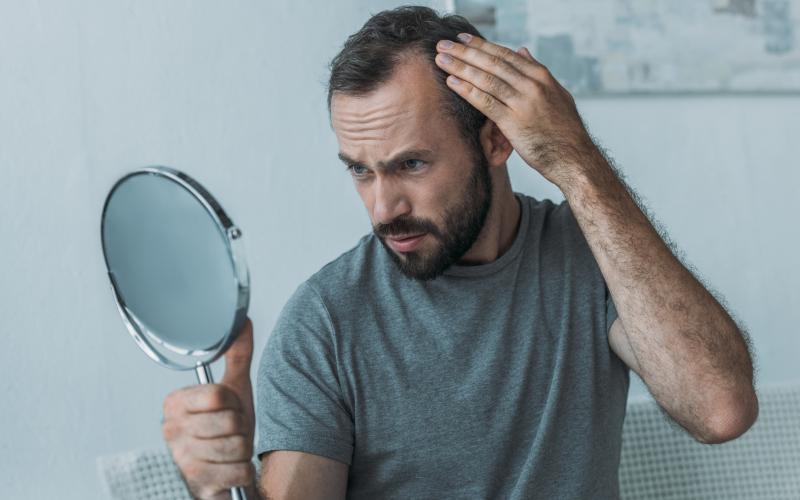 main of There Are More Causes of Hair Loss Than Most People Realize