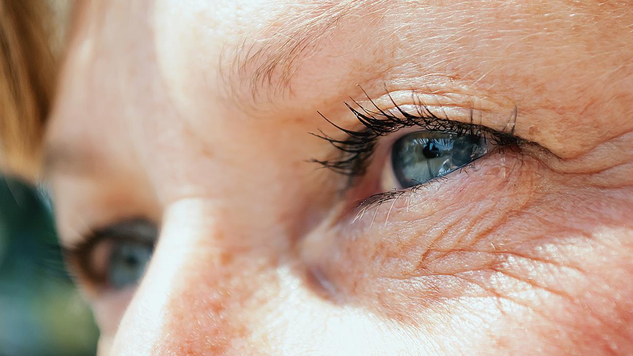 Cataracts Cause the Lens of the Eye to Cloudy