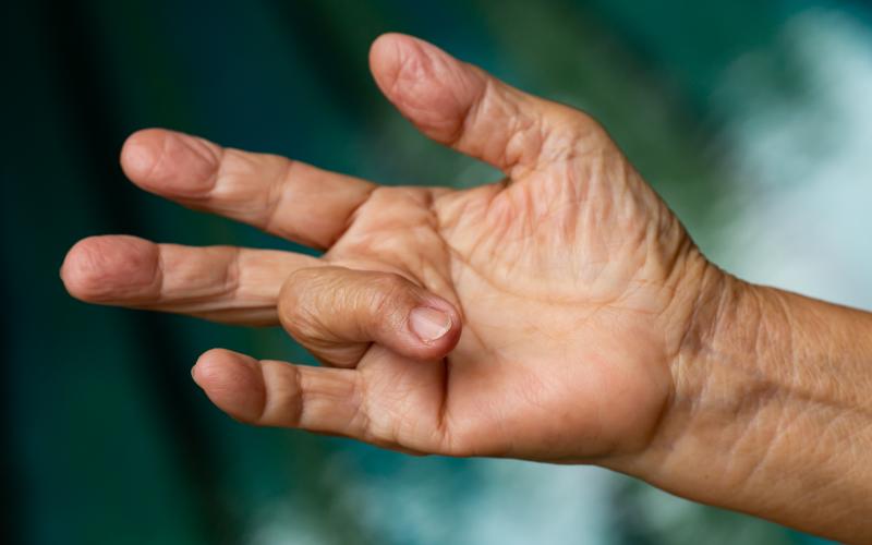 main of Sufferers of Trigger Finger May be Shocked How Their Finger Behaves (healthsmarted)