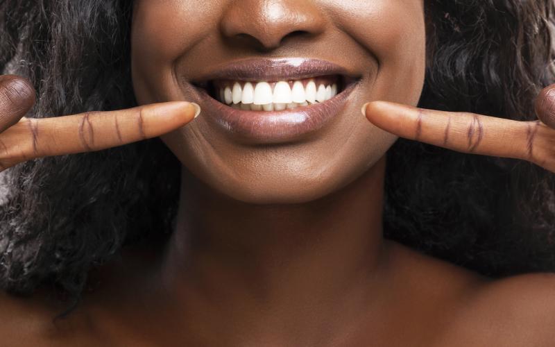 main of Teeth Whitening Can Be Handled by the Pros or Performed at Home (healthsmarted)