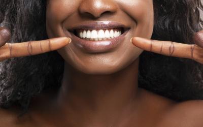 thumbnail of Teeth Whitening Can Be Handled by the Pros or Performed at Home (healthsmarted)